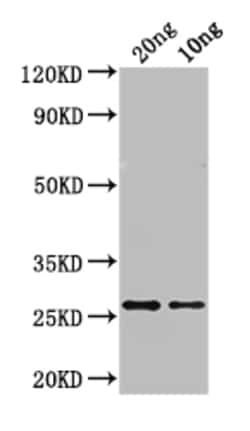 Invitrogen ASE1 Polyclonal Antibody 100 &mu;L; Unconjugated:Antibodies,