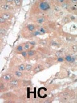 Invitrogen p21 Polyclonal Antibody 400 &mu;L; Unconjugated:Antibodies,