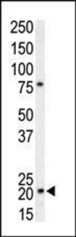 Invitrogen p21 Polyclonal Antibody 400 &mu;L; Unconjugated:Antibodies,