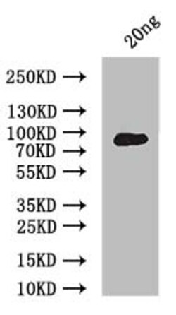 Invitrogen ERVK-5 Polyclonal Antibody 100 &mu;L; Unconjugated:Antibodies,