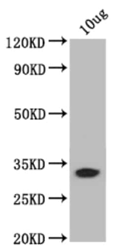 Invitrogen bamB Polyclonal Antibody 100 &mu;L; Unconjugated:Antibodies,