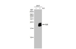Invitrogen&trade;&nbsp;IL-6 Polyclonal Antibody