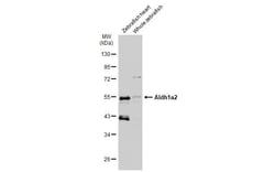 Invitrogen ALDH1A2 Polyclonal Antibody 100 &mu;L; Unconjugated:Antibodies,
