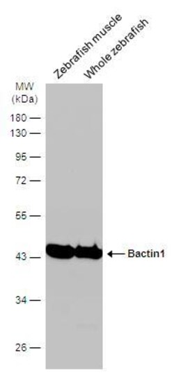 Invitrogen beta Actin Polyclonal Antibody 100 &mu;L | Buy Online | Invitrogen&trade; | Fisher Scientific