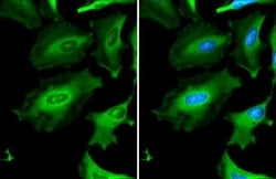 Invitrogen GAPDH Polyclonal Antibody 100 &mu;L | Buy Online | Invitrogen&trade; | Fisher Scientific