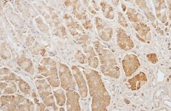 Invitrogen GAPDH Polyclonal Antibody 100 &mu;L | Buy Online | Invitrogen&trade; | Fisher Scientific