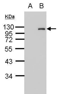 Invitrogen&trade;&nbsp;HA Tag Polyclonal Antibody