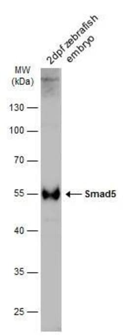 Invitrogen SMAD5 Polyclonal Antibody 100 &mu;L; Unconjugated:Antibodies,