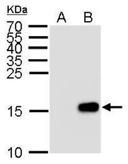 Invitrogen Phospho-Histone H3 (Ser28) Polyclonal Antibody 100 &mu;L; Unconjugated:Antibodies,