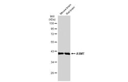 Invitrogen ASMT Polyclonal Antibody 100 &mu;L; Unconjugated:Antibodies,