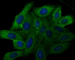 Invitrogen TRPV6 Polyclonal Antibody 100 &mu;L; Unconjugated:Antibodies,