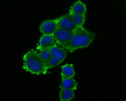 Invitrogen TRPV6 Polyclonal Antibody 100 &mu;L; Unconjugated:Antibodies,