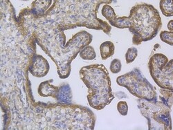 Invitrogen TRPV6 Polyclonal Antibody 100 &mu;L; Unconjugated:Antibodies,