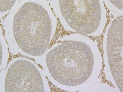 Invitrogen TRPV6 Polyclonal Antibody 100 &mu;L; Unconjugated:Antibodies,