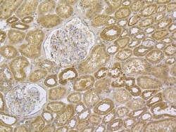 Invitrogen TRPV6 Polyclonal Antibody 100 &mu;L; Unconjugated:Antibodies,
