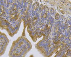 Invitrogen TRPV6 Polyclonal Antibody 100 &mu;L; Unconjugated:Antibodies,