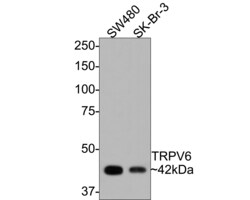 Invitrogen TRPV6 Polyclonal Antibody 100 &mu;L; Unconjugated:Antibodies,