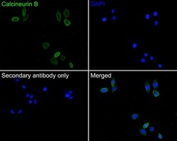 Invitrogen Calcineurin B Polyclonal Antibody 100 &mu;L; Unconjugated:Antibodies,