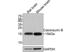 Invitrogen Calcineurin B Polyclonal Antibody 100 &mu;L; Unconjugated:Antibodies,