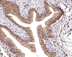 Invitrogen TMED5 Polyclonal Antibody 100 &mu;L | Buy Online | Invitrogen&trade; | Fisher Scientific