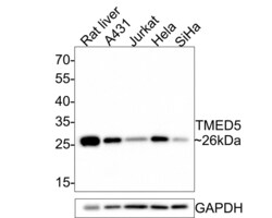 Invitrogen TMED5 Polyclonal Antibody 100 &mu;L | Buy Online | Invitrogen&trade; | Fisher Scientific