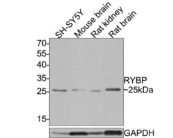 Invitrogen RYBP Polyclonal Antibody 100 &mu;L; Unconjugated:Antibodies,