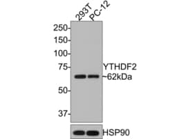 Invitrogen YTHDF2 Polyclonal Antibody 100 &mu;L; Unconjugated:Antibodies,