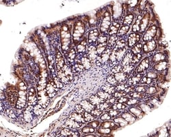 Invitrogen PSMD2 Polyclonal Antibody 100 &mu;L; Unconjugated:Antibodies,