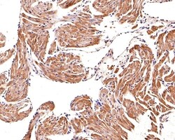 Invitrogen PSMD2 Polyclonal Antibody 100 &mu;L; Unconjugated:Antibodies,