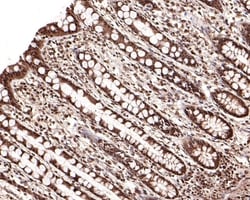 Invitrogen PSMD7 Polyclonal Antibody 100 &mu;L; Unconjugated:Antibodies,