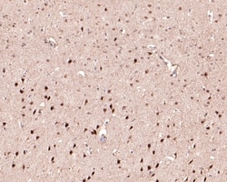 Invitrogen PSMD7 Polyclonal Antibody 100 &mu;L; Unconjugated:Antibodies,