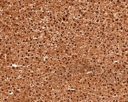 Invitrogen RUVBL1 Polyclonal Antibody 100 &mu;L; Unconjugated:Antibodies,