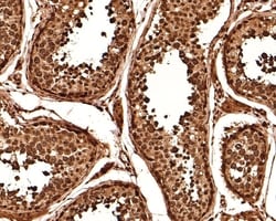 Invitrogen RUVBL1 Polyclonal Antibody 100 &mu;L; Unconjugated:Antibodies,
