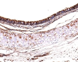 Invitrogen RUVBL1 Polyclonal Antibody 100 &mu;L; Unconjugated:Antibodies,