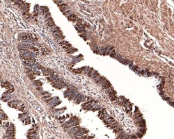 Invitrogen RUVBL1 Polyclonal Antibody 100 &mu;L; Unconjugated:Antibodies,