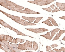 Invitrogen RUVBL1 Polyclonal Antibody 100 &mu;L; Unconjugated:Antibodies,