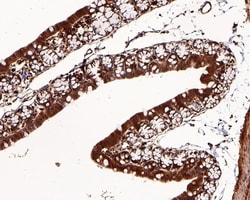 Invitrogen BTRC Polyclonal Antibody 100 &mu;L; Unconjugated:Antibodies,