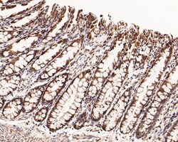 Invitrogen BTRC Polyclonal Antibody 100 &mu;L; Unconjugated:Antibodies,