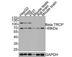 Invitrogen BTRC Polyclonal Antibody 100 &mu;L; Unconjugated:Antibodies,