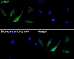 Invitrogen DAB2IP Polyclonal Antibody 100 &mu;L; Unconjugated:Antibodies,