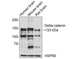 Invitrogen Catenin delta-2 Polyclonal Antibody 100 &mu;L | Buy Online | Invitrogen&trade; | Fisher Scientific