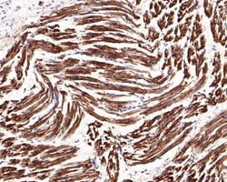 Invitrogen IL-6 Receptor Polyclonal Antibody 100 &mu;L | Buy Online | Invitrogen&trade; | Fisher Scientific