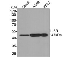 Invitrogen IL-6 Receptor Polyclonal Antibody 100 &mu;L | Buy Online | Invitrogen&trade; | Fisher Scientific