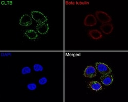 Invitrogen CLBT Polyclonal Antibody 100 &mu;L | Buy Online | Invitrogen&trade; | Fisher Scientific