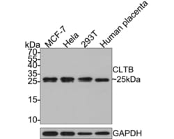 Invitrogen CLBT Polyclonal Antibody 100 &mu;L | Buy Online | Invitrogen&trade; | Fisher Scientific