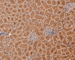 Invitrogen PSMA4 Polyclonal Antibody 100 &mu;L; Unconjugated:Antibodies,