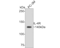 Invitrogen IL4R Polyclonal Antibody 100 &mu;L; Unconjugated:Antibodies,