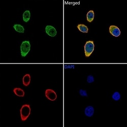 Invitrogen PSMB3 Polyclonal Antibody 100 &mu;L; Unconjugated:Antibodies,