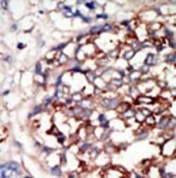 Invitrogen DYRK1B Polyclonal Antibody 400 &mu;L; Unconjugated:Antibodies,