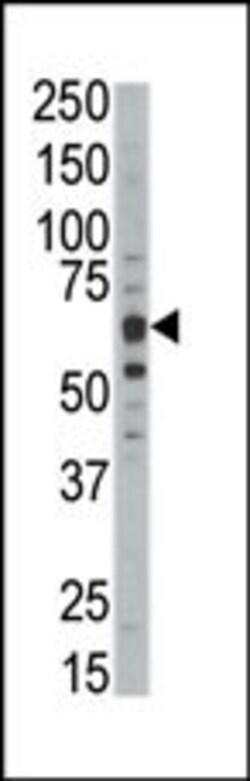 Invitrogen DYRK1B Polyclonal Antibody 400 &mu;L; Unconjugated:Antibodies,